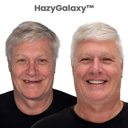 🔥HazyGalaxy™ Custom-Fit Dentures ⏰ ENDS TODAY   70% OFF | Smile with Confidence
