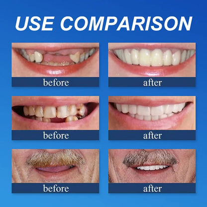 ⏰Ends Today: 75% OFF!⏰  Strong adsorption 🦷T